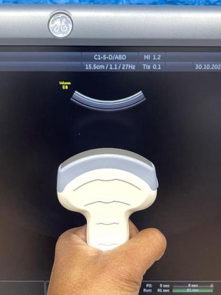 GE Voluson E8，诞生时间：2011年