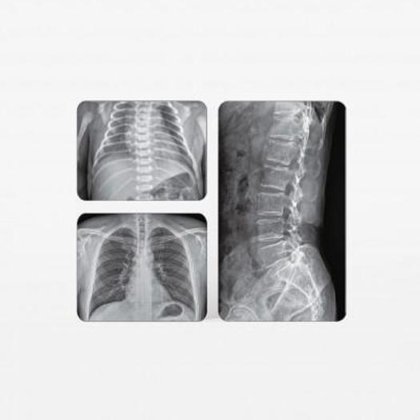 数字肺无线电室、浮动台、立式陶器、平面传感器