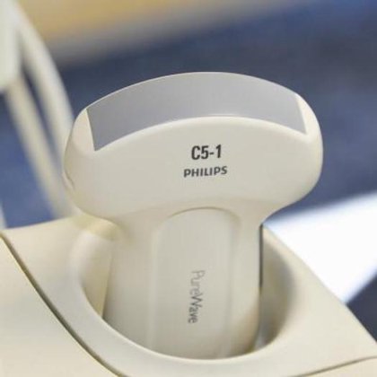 フィリップス IU22 超音波