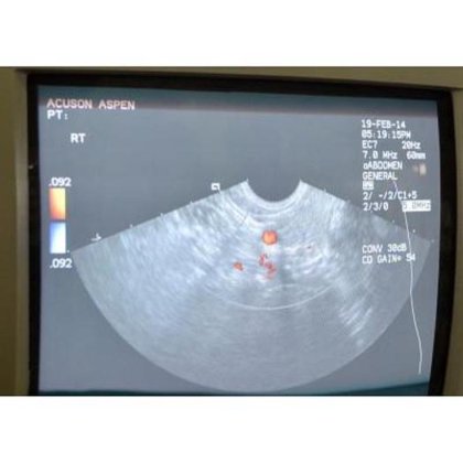 ACUSON ASPEN IMAGEGATE 超声波带 6