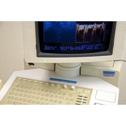 日立オデッシー エコードップラー超音波