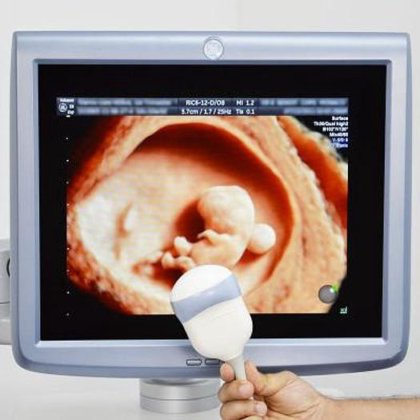 VOLUSON E8 通用电气带音量探头