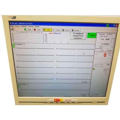 トレッドミルを使用したシラー心電図運動テスト