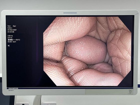 奥林巴斯瞄准镜型号:PCF-H180AL