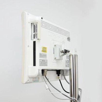 ビデオ コルポスコープ カッパ ドイツ