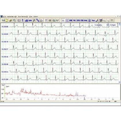 3 通道动态心电图