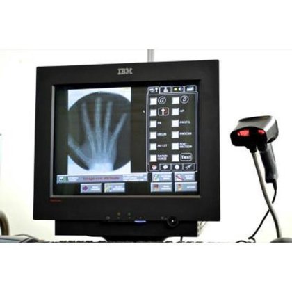 柯达 CR500 扫描系统