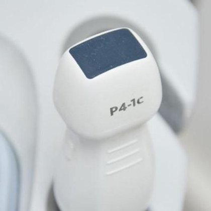 マインドレイ・ゾナレ心エコー検査者