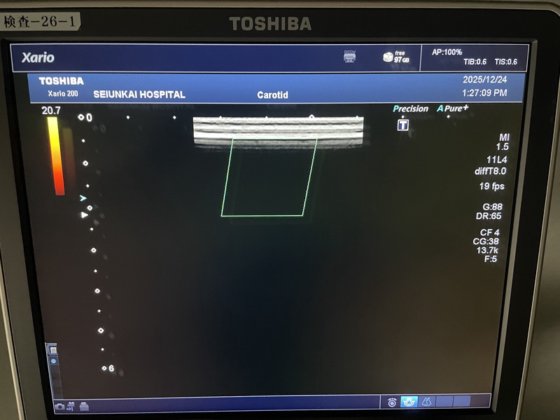 キャノン Xario 200