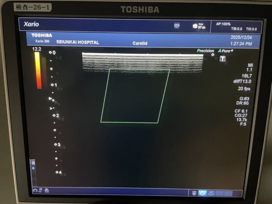 キャノン Xario 200