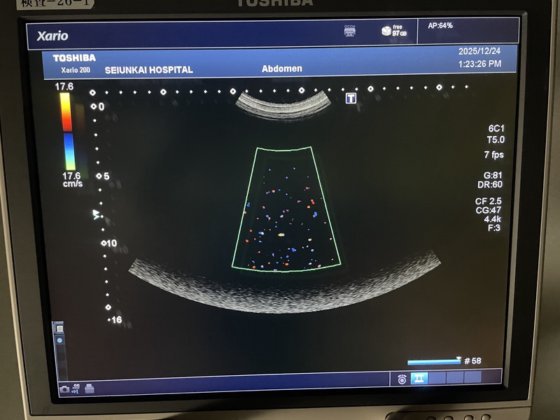 キャノン Xario 200