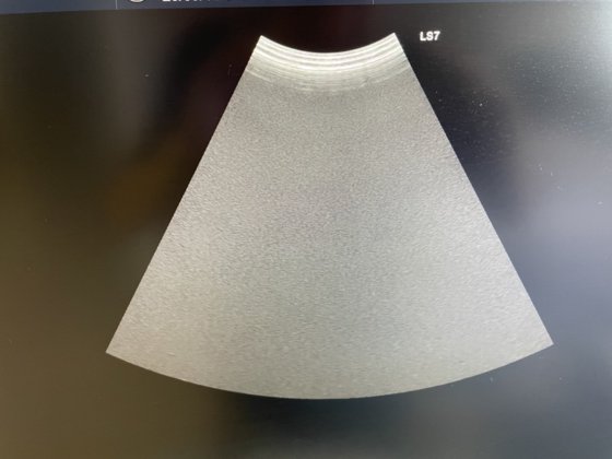 2018 GE Logiq S7 Expert