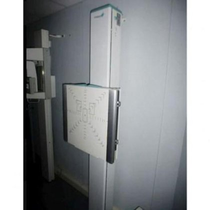 STEPHANIX RAD E+ 肺骨室