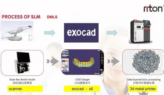 工業用光硬化SLA 3Dプリンター大型3D印刷機ラピッドプロトタイピング