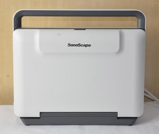SONOSCAPE E2 Exp