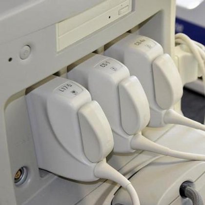 フィリップス IU22 超音波