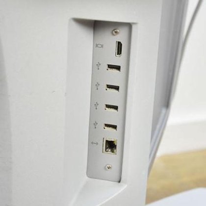 マインドレイ・ゾナレ心エコー検査者