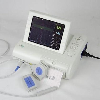 便携式凸轮心电图仪