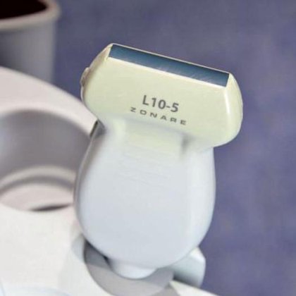 マインドレイ ゾナーレ超音波