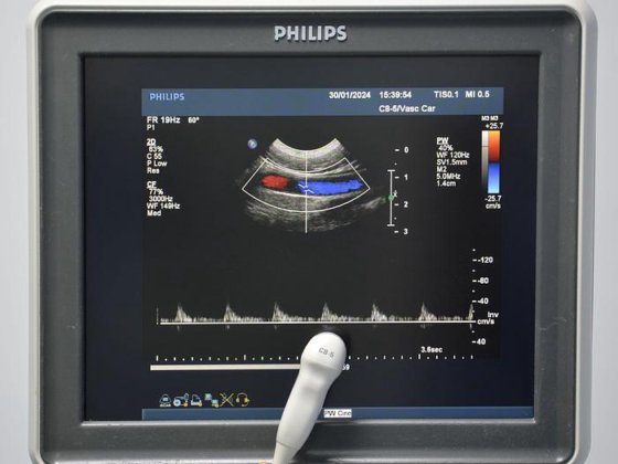 PHILIPS IU22