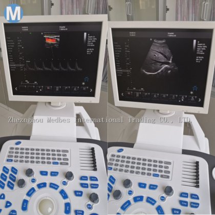 96 Elements Trolley 4D Ultrasound Scanner in Henan, China