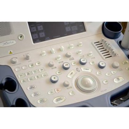 東芝ザリオ超音波