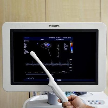フィリップス IU22 超音波