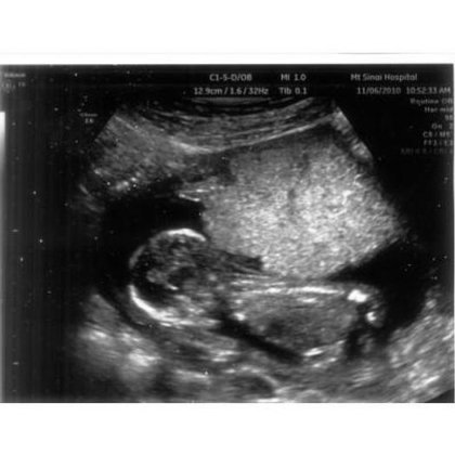 ヴォルソン E6 BT 10