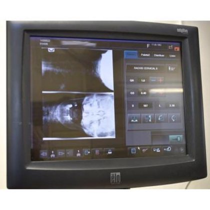 富士胶片扫描系统