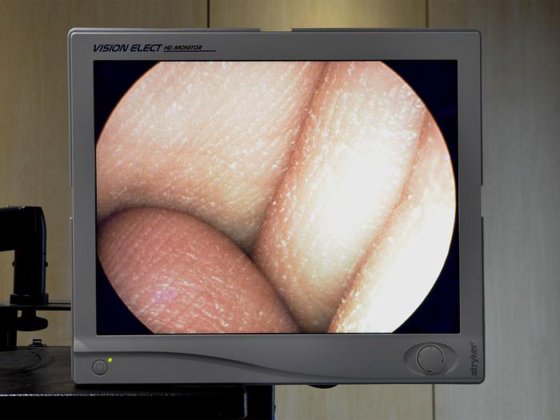 オリンパス直角鏡セット