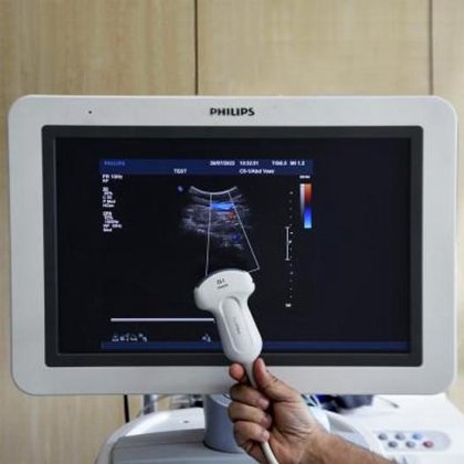 フィリップス IU22 超音波