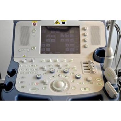 東芝ザリオ超音波