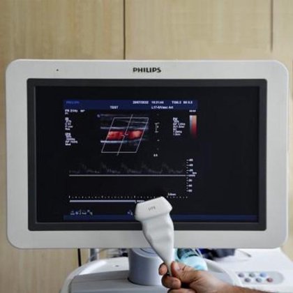 フィリップス IU22 超音波