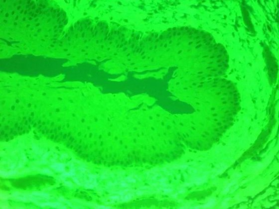 Olympus IX70 Inverted Fluorescence Microscope