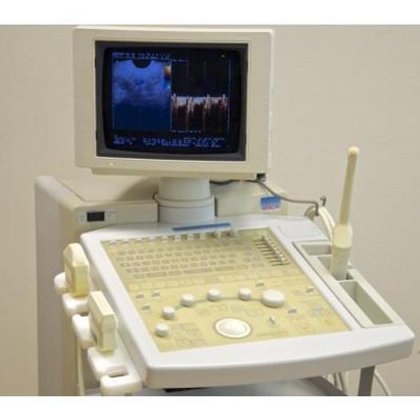 日立オデッシー エコードップラー超音波