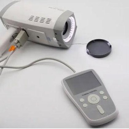 便携式数字阴道镜