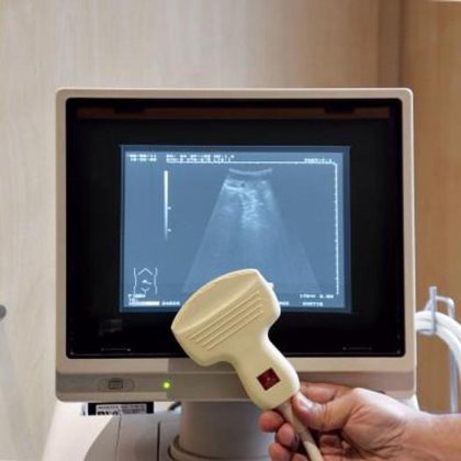 日立 EUB-420 超声波