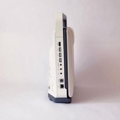 SONOSCAPE EXPERT E2 心臓プローブ付きポータブル心エコー検査装置