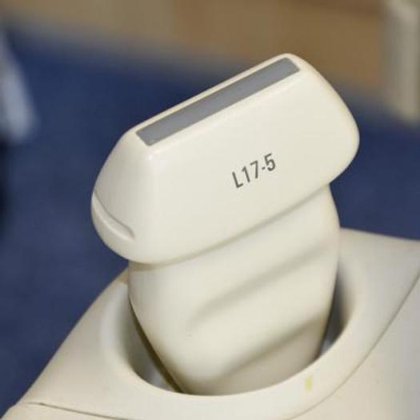 フィリップス IU22 超音波