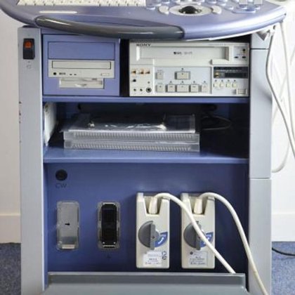 一般電気超音波グラファー VOLUSON 730 エキスパート 2002