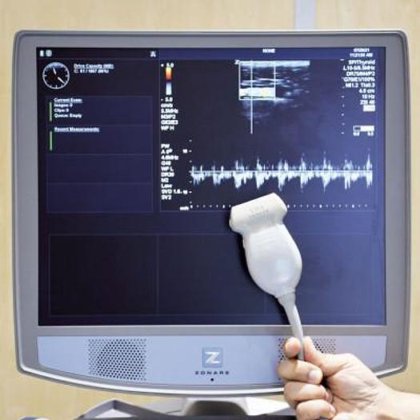 マインドレイ ゾナーレ超音波