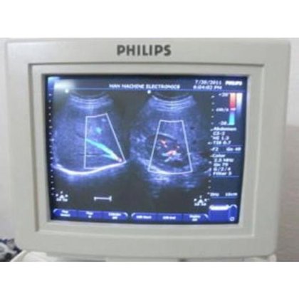 飞利浦 ENVISOR 高清彩色超声波 3 个探头