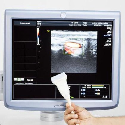 VOLUSON E8 通用电气带音量探头