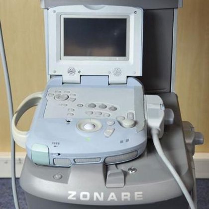 迈瑞ZONARE超声