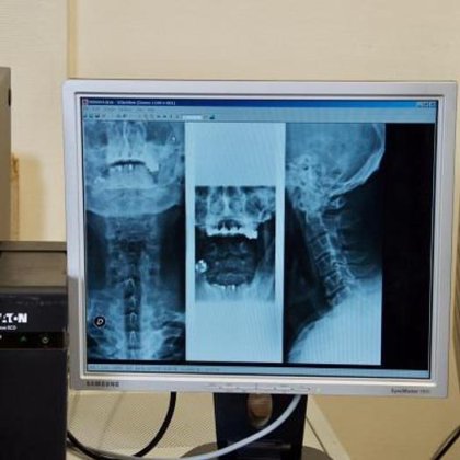 KODAK DIRECTVIEW CR500 DIGITIZING SYSTEM