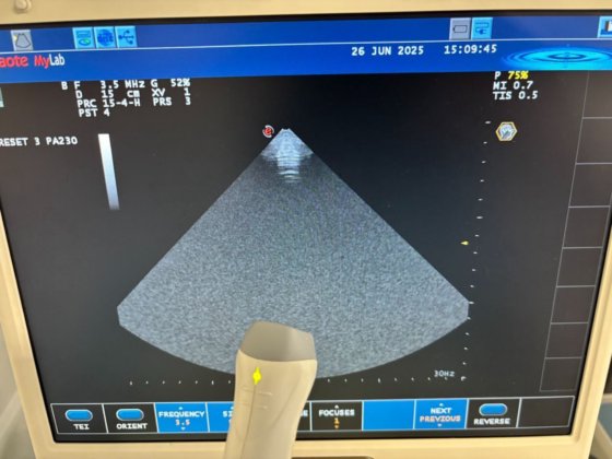 ESAOTE PA230E