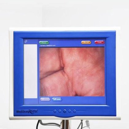 ビデオ コルポスコープ カッパ ドイツ