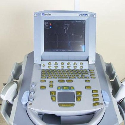 便携式 Sonosite 超声波