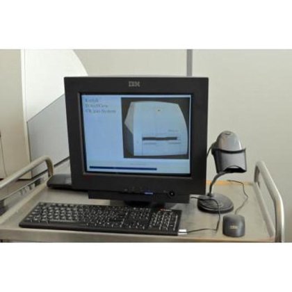 柯达 CR500 扫描系统