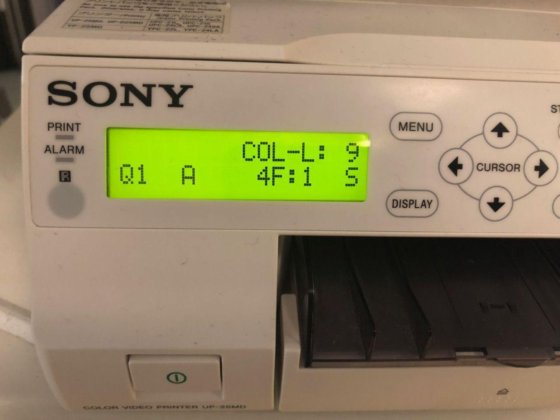 - 二手索尼 UP-25MD - 索尼